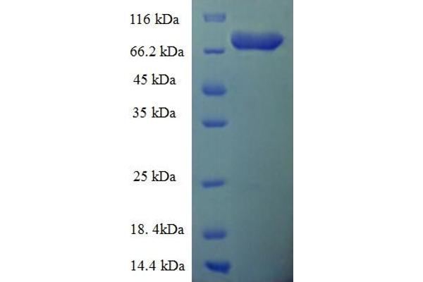 EPHX2 Protein (AA 1-555, full length) (His-SUMO Tag)
