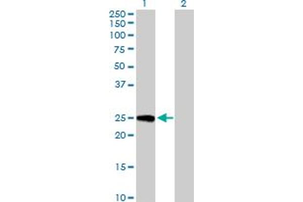 anti-GINS Complex Subunit 3 (Psf3 Homolog) (GINS3) (AA 1-216) antibody