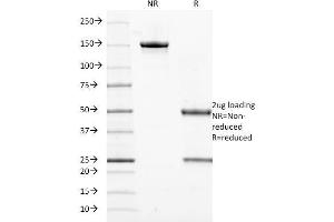 Image no. 5 for anti-Keratin 18 (KRT18) antibody (ABIN6939931)