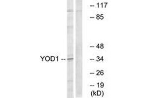 anti-Ubiquitin Thioesterase OTU1 (YOD1) (AA 116-165) antibody