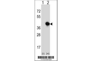 Image no. 3 for anti-Replication Factor C (Activator 1) 5, 36.5kDa (RFC5) (AA 170-200) antibody (ABIN389314)