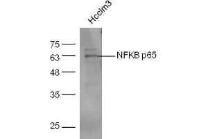 Image no. 4 for anti-Nuclear Factor-kB p65 (NFkBP65) (AA 50-100) antibody (ABIN668961)