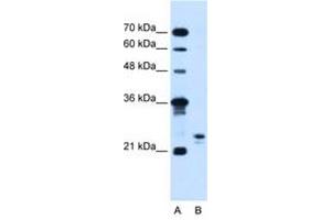 Image no. 2 for anti-Motile Sperm Domain Containing 3 (MOSPD3) (C-Term) antibody (ABIN205067)