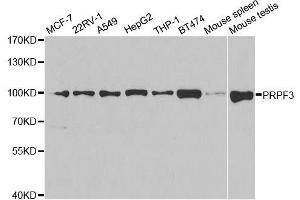 Image no. 1 for anti-PRP3 Pre-mRNA Processing Factor 3 Homolog (PRPF3) antibody (ABIN6146260)