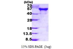 tau Protein (AA 1-383) (His tag)