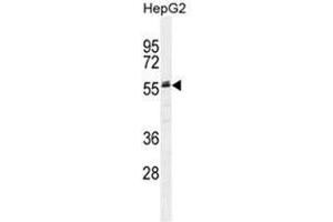 Image no. 4 for anti-alpha-2-HS-Glycoprotein (AHSG) (AA 254-284), (C-Term) antibody (ABIN950366)