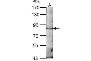 Image no. 4 for anti-Echinoderm Microtubule Associated Protein Like 1 (EML1) (C-Term) antibody (ABIN2854673)
