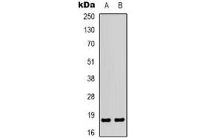 Image no. 2 for anti-Myosin Regulatory Light Chain 2, Smooth Muscle Isoform (MYL9) (N-Term) antibody (ABIN2801281)