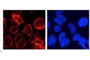Image no. 3 for anti-Nucleoporin 210kDa (NUP210) (N-Term) antibody (ABIN108646)