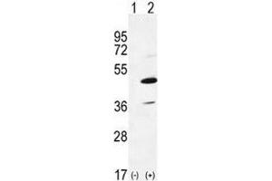 Image no. 2 for anti-Interleukin-1 Receptor-Associated Kinase 4 (IRAK4) (AA 5-36) antibody (ABIN3031498)