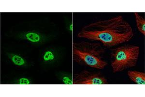 Image no. 1 for anti-Heterogeneous Nuclear Ribonucleoprotein H1 (H) (HNRNPH1) (Center) antibody (ABIN2855275)