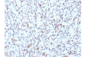Image no. 3 for anti-Myogenic Differentiation 1 (MYOD1) antibody (ABIN6940160)