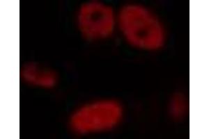 ABIN6274448 staining HepG2 cells by IF/ICC.