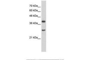 Image no. 1 for anti-Cytosolic Iron-Sulfur Protein Assembly 1 (CIAO1) (AA 247-296) antibody (ABIN203313)
