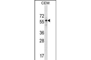 DPH2 Antibody (N-term) (ABIN1538986 and ABIN2849764) western blot analysis in CEM cell line lysates (35 μg/lane).