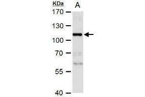 Image no. 3 for anti-NLR Family, Pyrin Domain Containing 2 (NLRP2) (Center) antibody (ABIN2855584)
