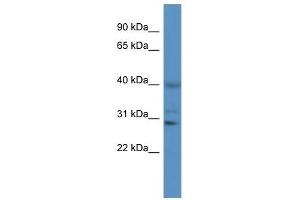 Image no. 1 for anti-Cathepsin S (CTSS) (N-Term) antibody (ABIN926631)