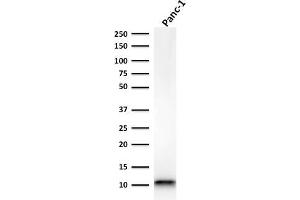 Western Blotting (WB) image for anti-S100 Calcium Binding Protein A4 (S100A4) (AA 1-200) antibody (ABIN6940544)