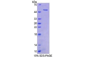 Image no. 1 for Cerebellin 1 Precursor (CBLN1) (AA 22-193) protein (His tag,GST tag) (ABIN6237156)