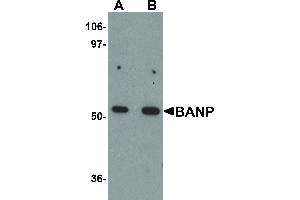 Image no. 1 for anti-Protein BANP (BANP) (Internal Region) antibody (ABIN6656119)