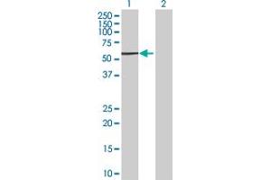 Western Blot analysis of RNF25 expression in transfected 293T cell line by RNF25 MaxPab polyclonal antibody.