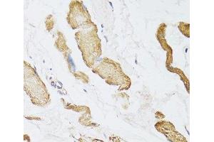 CKMT2 antibody