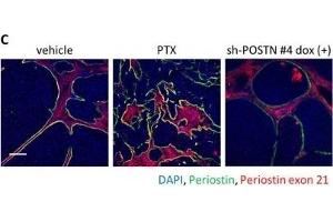 Image no. 13 for anti-Periostin (POSTN) (C-Term) antibody (ABIN2854805)