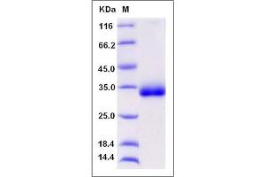 Image no. 1 for Chondrolectin (CHODL) (AA 1-216) protein (His tag) (ABIN2009582)
