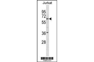 Western Blotting (WB) image for anti-F-Box and WD Repeat Domain Containing 5 (FBXW5) (Center) antibody (ABIN2161156)