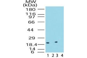 Image no. 1 for anti-Dual Specificity Phosphatase 18 (DUSP18) (AA 1-50) antibody (ABIN207658)