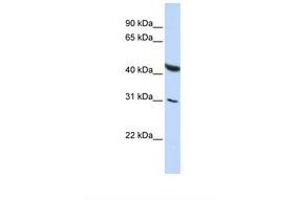 CELF6 anticorps  (AA 254-303)