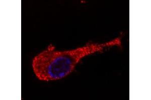 Image no. 2 for anti-Neurofilament Triplet M Protein (NEFM) antibody (ABIN94435)