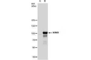 Image no. 1 for anti-Inhibitor of kappa Light Polypeptide Gene Enhancer in B-Cells, Kinase beta (IKBKB) (C-Term) antibody (ABIN2856162)