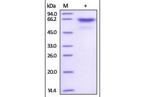 Human Akt1, His Tag & Strep Tag on SDS-PAGE under reducing (R) condition.