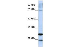 Image no. 1 for anti-Glutathione S-Transferase alpha 4 (GSTA4) (C-Term) antibody (ABIN631150)