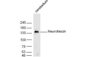 Image no. 4 for anti-Neurofascin (NFASC) (AA 501-650) antibody (ABIN727325)