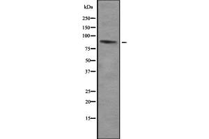 Image no. 1 for anti-Zinc Finger Protein 785 (ZNF785) antibody (ABIN6266137)