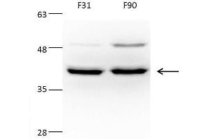 Image no. 5 for anti-Acetyl-CoA Acetyltransferase 1 (ACAT1) (N-Term) antibody (ABIN2855445)