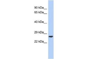 Image no. 1 for anti-DIRAS Family, GTP-Binding RAS-Like 1 (DIRAS1) (Middle Region) antibody (ABIN634443)