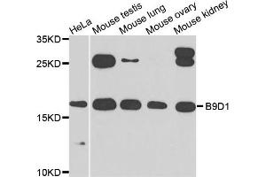 Image no. 2 for anti-B9 Protein Domain 1 (B9D1) antibody (ABIN2736339)