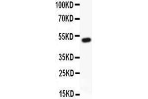 Image no. 3 for anti-Runt-Related Transcription Factor 1 (RUNX1) (AA 200-233), (Middle Region) antibody (ABIN3043318)