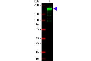 Image no. 2 for anti-alpha-2-Macroglobulin (A2M) antibody (ABIN103762)