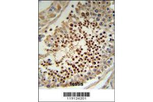 Image no. 2 for anti-Kruppel-Like Factor 5 (Intestinal) (KLF5) (AA 341-370), (C-Term) antibody (ABIN391515)