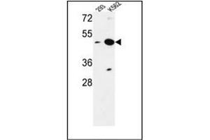 Image no. 1 for anti-Nucleoporin Like 2 (NUPL2) (AA 94-124), (N-Term) antibody (ABIN953795)