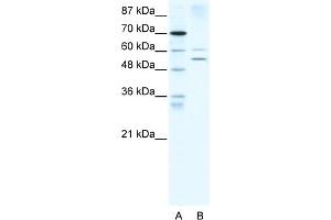 Image no. 1 for anti-Autoimmune Regulator (AIRE) (N-Term) antibody (ABIN2779776)