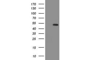 Image no. 6 for anti-Mannose Phosphate Isomerase (MPI) antibody (ABIN1499543)