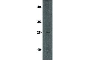 Image no. 1 for anti-Killer Cell Lectin-Like Receptor, Subfamily A, Member 3 (Klra3) (C-Term) antibody (ABIN6657458)