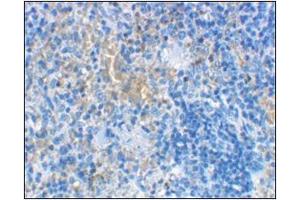 Image no. 2 for anti-Lymphocyte Antigen 96 (LY96) (Center) antibody (ABIN500262)