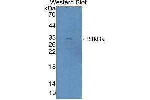 Image no. 2 for anti-BCL6 Co-Repressor (BCOR) (AA 1553-1755) antibody (ABIN5013229)