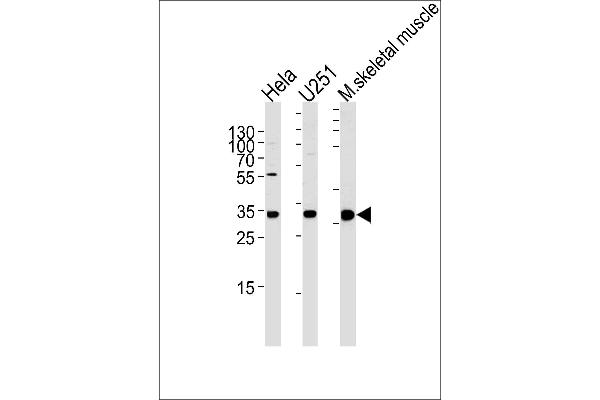 anti-Polymerase (RNA) II (DNA Directed) Polypeptide C, 33kDa (POLR2C) (AA 200-228), (C-Term) antibody